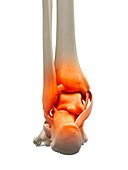 Human ankle bone,artwork