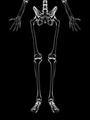 Human leg bones,artwork