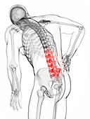 Human back pain,artwork