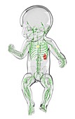 Baby's lymphatic system,artwork