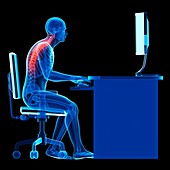 Person sitting with incorrect posture