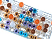 Medical samples in a test tube rack