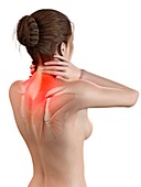 Human neck pain,illustration