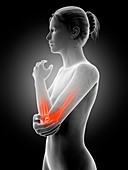 Human elbow joint pain,illustration