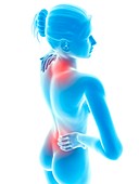 Human neck and back pain,illustration