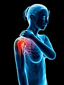 Human shoulder pain,illustration