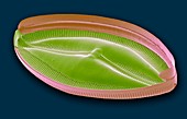 Diatom,SEM