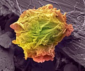 Lymphoma cancer cell,SEM