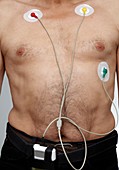 Man with ecg electrodes