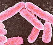 E coli bacteria,SEM