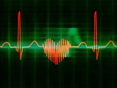 Heart-shaped ECG trace
