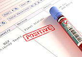 Positive HIV blood test,illustration