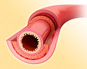 Small intestine wall,illustration