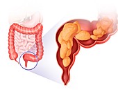 Large intestine,illustration