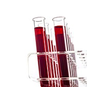 Blood samples in test tubes
