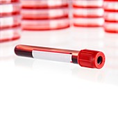 Blood collection tube