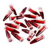 Blood samples in centrifuge tubes