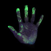 UV light showing bacteria on hand