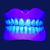 Model teeth in UV light