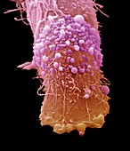 Skin cancer cell,SEM