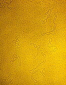 Tinted TEM of a group of bacterial DNA plasmids
