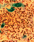 Coloured TEM of a section through ribosomes