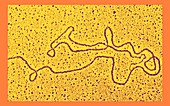 DNA strand telomere,TEM