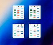 Paternity testing by analysis of DNA fingerprints
