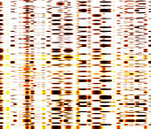 DNA autoradiogram