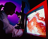 Medical researcher using a video light microscope