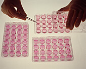 Researcher's hands & cover slips in cell cultures