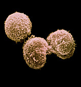 SEM of hybridoma cells