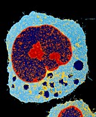 Coloured TEM of a section through a HeLa cell