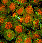 Immunofluorescent LM of HeLa cancer cells