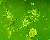Neuronal stem cells,light micrograph