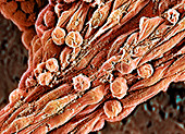 Human embryonic stem cells,SEM