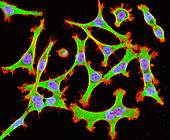 Cultured HeLa cells,light micrograph