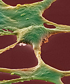 Human embryonic kidney cells,SEM