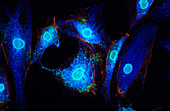 Human endothelial cells,light micrograph