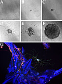 Brain cell differentiation,stem cells