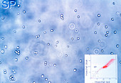 Screening stem cells,light micrograph