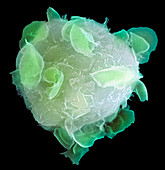 Bone marrow stem cell,SEM