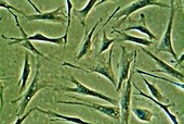 Fibroblast stem cells,light micrograph