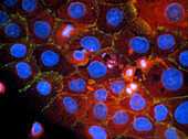 Immunfluorescent LM of cell death (apoptosis)