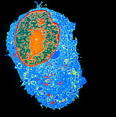 TEM of a single mammalian cell