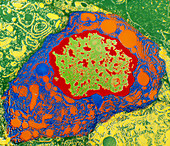 Coloured TEM of whole epithelial cell