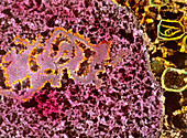 Coloured SEM of nucleolus and chromatin fibres