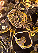 Coloured SEM of lysosomes in pancreas cell