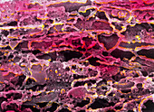 Coloured SEM of endoplasmic reticulum