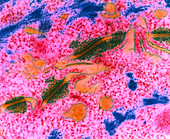 Coloured TEM of desmosomes in healthy human skin